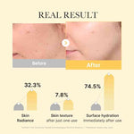 Load image into Gallery viewer, MEDICUBE Kojic Acid Turmeric Overnight Wrapping Mask