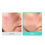 Load image into Gallery viewer, MEDICUBE Azelaic Acid 16 BB Calming Serum