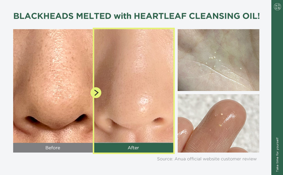 ANUA heartleaf cleansing oil