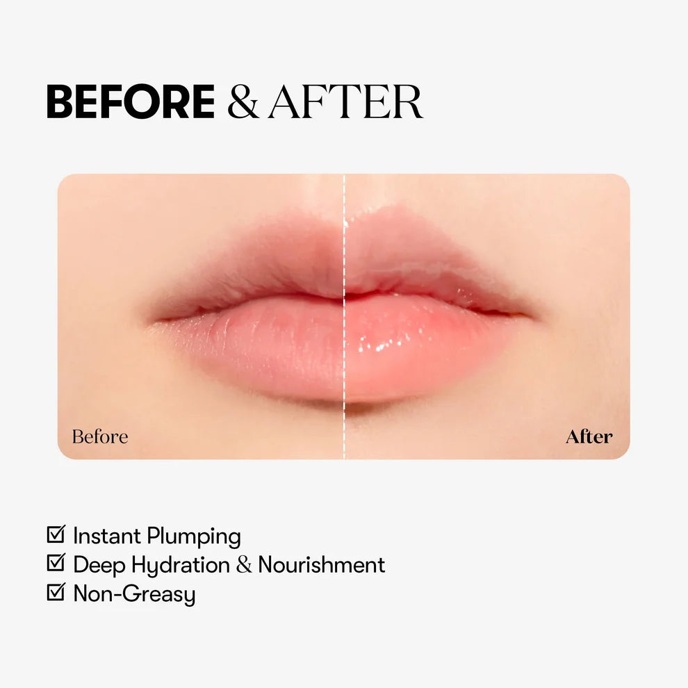 VT COSMETICS Reedle Shot Lip Plumper Beginner