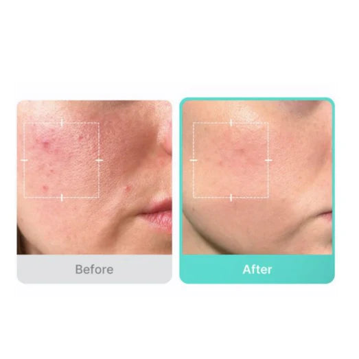 MEDICUBE Azelaic Acid 16 BB Calming Serum